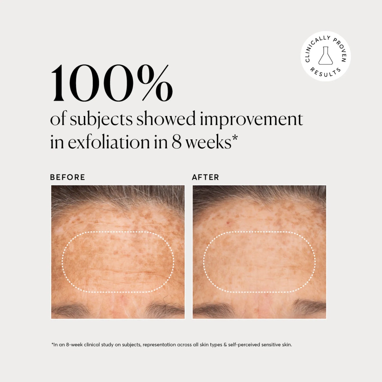 bha-liquid-exfoliant-2-y2 NATR-10027-Alt-Images-BHA-Liquid-Exfoliant-2_-03.webp