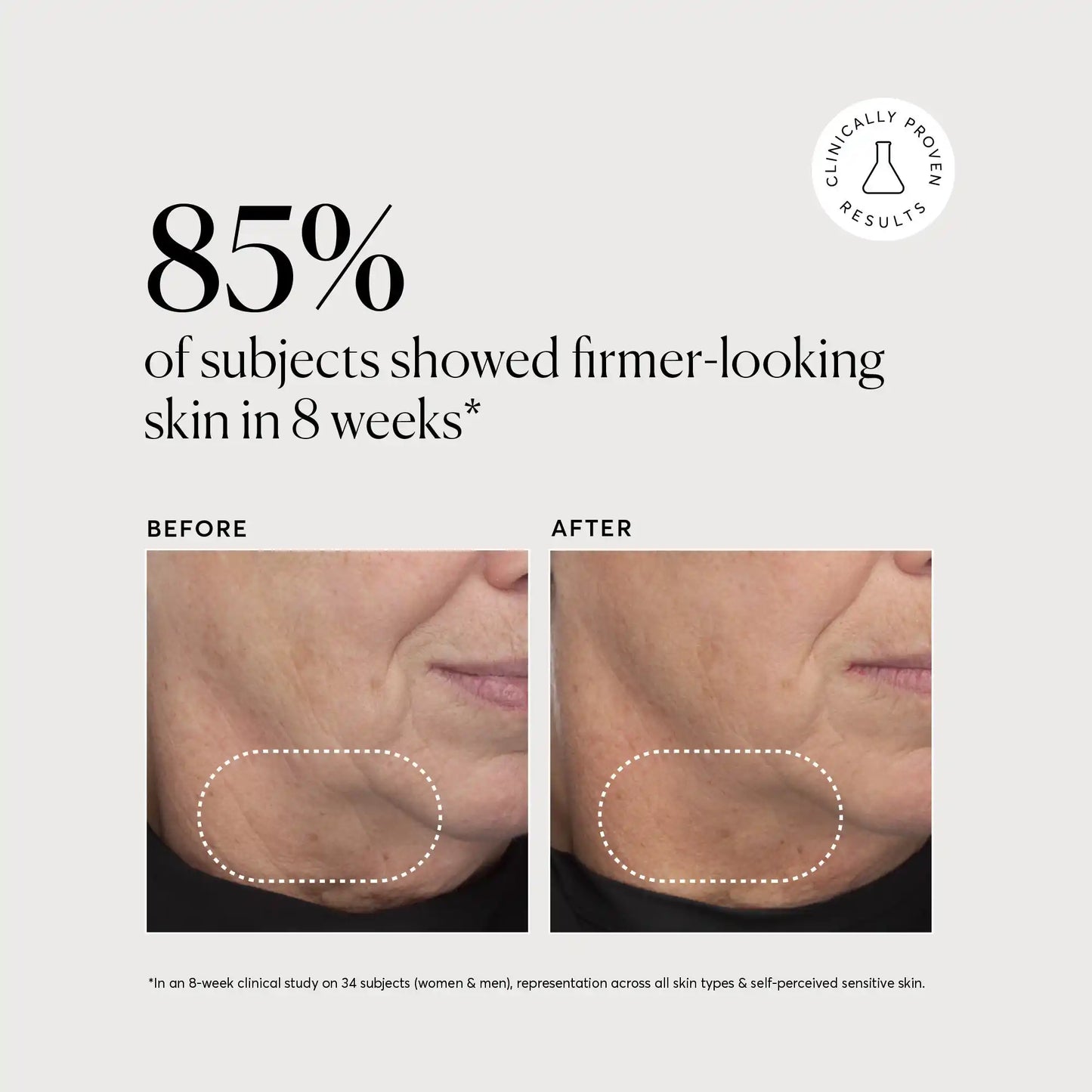 retinol-complex-serum-l4 NATR-10034-Alt-Images-Retinol-Complex-Serum-04.webp
